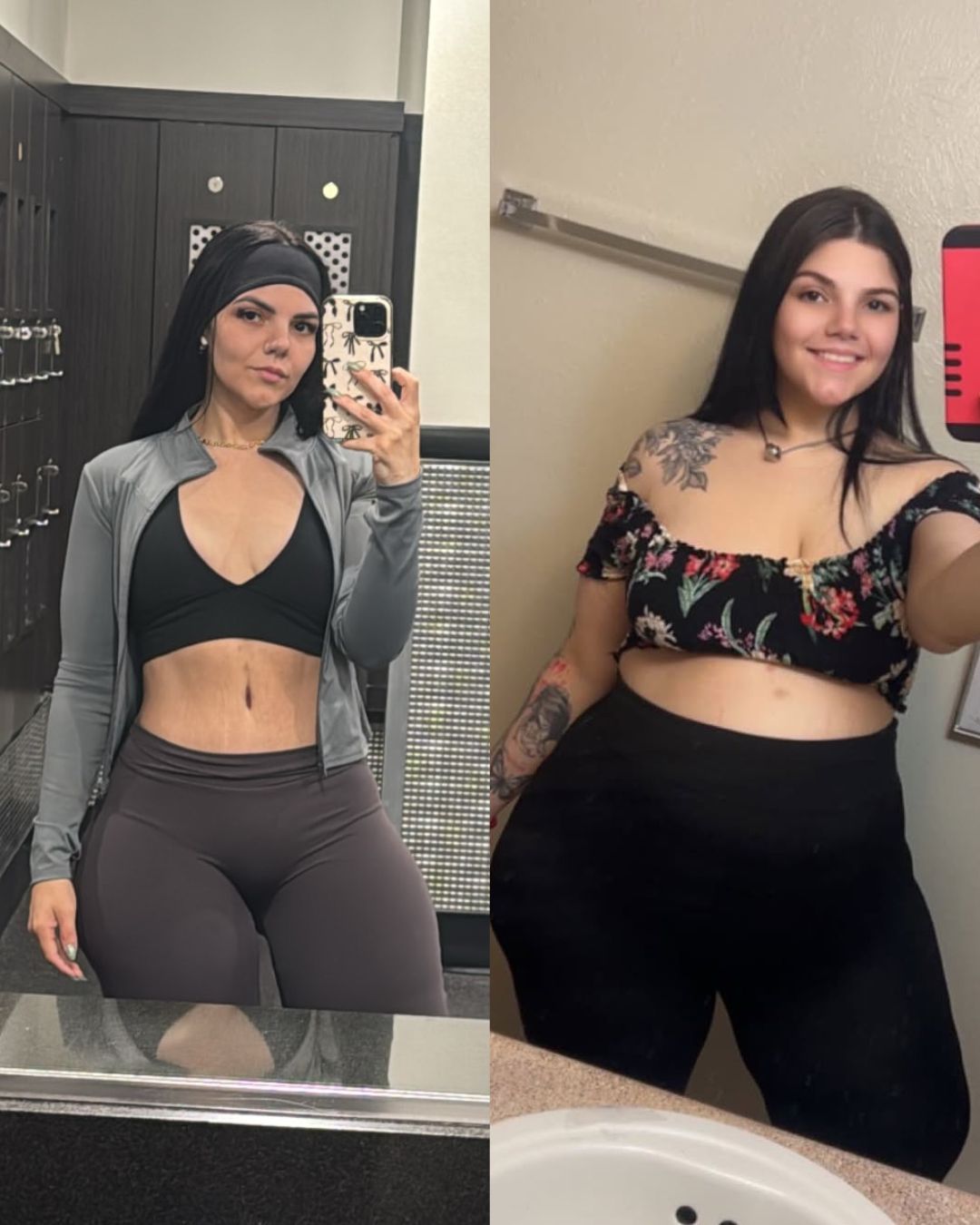 Body Sculpting · No Quirúrgico